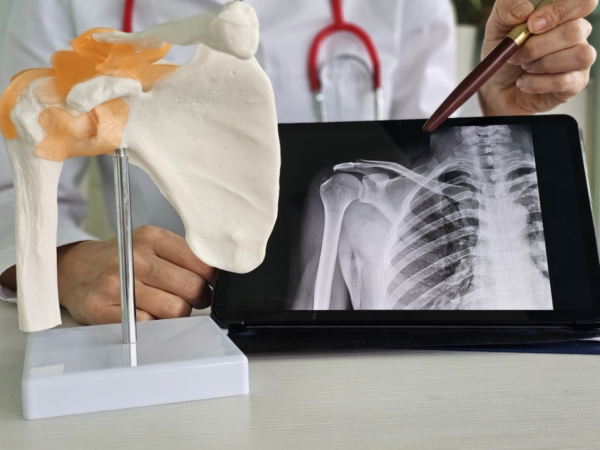 shoulder pain